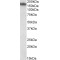 Neurofilament Medium Polypeptide (NEFM) Antibody