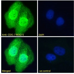 CSX1 Antibody