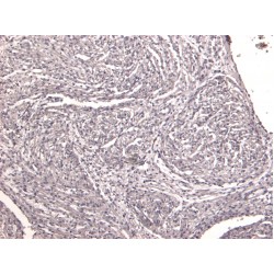 CSX1 Antibody