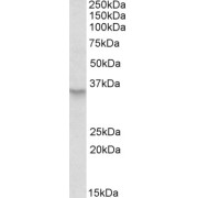 Peroxisomal Membrane Protein 3 (PXMP3) Antibody