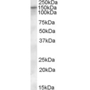 abx430102 (0.3 µg/ml) staining of Human Heart lysate (35 µg protein in RIPA buffer). Primary incubation was 1 hour. Detected by chemiluminescence.