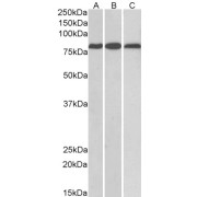 abx430120 (0.1 µg/ml) staining of Mouse (A) and Rat (B) Heart, and Rat Kidney (C) lysates (35 µg protein in RIPA buffer). Primary incubation was 1 hour. Detected by chemiluminescence.