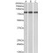 Probable E3 Ubiquitin-Protein Ligase MID2 (MID2) Antibody