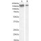 NCAM1 (Isoform 2) Antibody