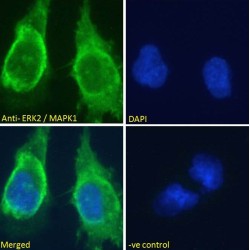 Mitogen-Activated Protein Kinase 1 / ERK2 (MAPK1) Antibody