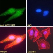 abx430135 Immunofluorescence analysis of paraformaldehyde fixed HeLa cells, permeabilized with 0.15% Triton. Primary incubation 1hr (10 µg/ml) followed by AF488 secondary antibody (2 µg/ml), showing nuclear and weak cytoplasmic weak staining. Actin filaments were stained with phalloidin (red) and the nuclear stain is DAPI (blue). Negative control: Unimmunized goat IgG (10 µg/ml) followed by AF488 secondary antibody (2 µg/ml).