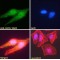 SUMO-Activating Enzyme Subunit 2 (SAE2) Antibody