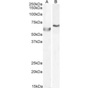 abx430146 (0.5 µg/ml) staining of A549 (A) and (1 µg/µl) HepG2 (B) cell lysate (35 µg protein in RIPA buffer). Primary incubation was 1 hour. Detected by chemiluminescence.