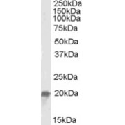 abx430159 (0.05 µg/ml) staining of Mouse Liver lysate (35 µg protein in RIPA buffer). Primary incubation was 1 hour. Detected by chemiluminescence.