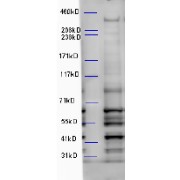 abx430167 (5 µg/ml) staining of Mouse Brain lysate (35 µg protein in RIPA buffer). Primary incubation was 1 hour. Detected by chemiluminescence.