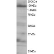 abx430169 staining (0.25 µg/ml) of 293 lysate (RIPA buffer, 35 µg total protein per lane). Primary incubated for 1 hour. Detected by western blot using chemiluminescence.