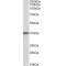 RNA-Binding Protein Musashi Homolog 2 (MSI2) Antibody