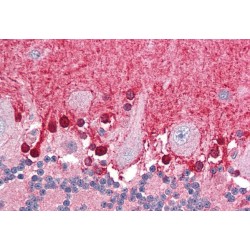 Ankyrin Repeat And BTB/POZ Domain-Containing Protein 1 (BPOZ) Antibody