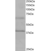 abx430177 staining (1 µg/ml) of Human Heart lysate (RIPA buffer, 35 µg total protein per lane). Primary incubated for 1 hour. Detected by western blot using chemiluminescence.