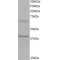 Ankyrin Repeat And BTB/POZ Domain-Containing Protein 1 (BPOZ) Antibody