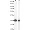 Chromobox Homolog 5 (CBX5) Antibody