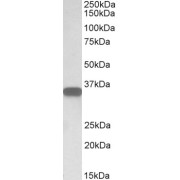 abx430201 (0.05 µg/ml) staining of Human Lymph Node lysate (35 µg protein in RIPA buffer). Detected by chemiluminescence.