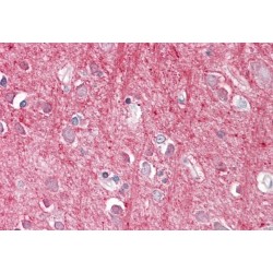 Thy-1 Membrane Glycoprotein (THY1) Antibody