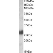 abx430205 (0.1 µg/ml) staining of Human Tonsil lysate (35 µg protein in RIPA buffer). Detected by chemiluminescence.