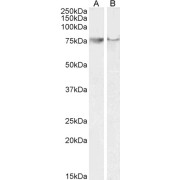 abx430212 (0.1 µg/ml) staining of A549 (A) and Daudi (B) cell lysate (35 µg protein in RIPA buffer). Detected by chemiluminescence.