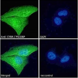 Pleckstrin Homology Sec7 And Coiled-Coil Domains-Binding Protein (PSCDBP) Antibody