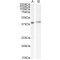 Pleckstrin Homology Sec7 And Coiled-Coil Domains-Binding Protein (PSCDBP) Antibody