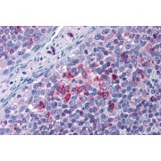 abx430227 (3.75 µg/ml) staining of paraffin embedded Human Tonsil. Steamed antigen retrieval with citrate buffer pH 6, AP-staining.