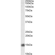 abx430242 (0.5 µg/ml) staining of Human Kidney lysate (35 µg protein in RIPA buffer). Primary incubation was 1 hour. Detected by chemiluminescence.