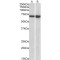 Lymphocyte Cytosolic Protein 1 (LCP1) Antibody