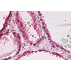 LIS1 Antibody