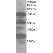 abx430260 staining (1 µg/ml) of Human Lung lysate (RIPA buffer, 30 µg total protein per lane). Primary incubated for 1 hour. Detected by western blot using chemiluminescence.