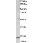 abx430263 staining (0.5 µg/ml) of human kidney lysate (RIPA buffer, 35 µg total protein per lane). Primary incubated for 1 hour. Detected by western blot using chemiluminescence.