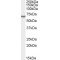 Phosphoenolpyruvate Carboxykinase, Cytosolic (PCK1) Antibody