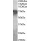 Phosphoenolpyruvate Carboxykinase, Mitochondrial (PCK2) Antibody