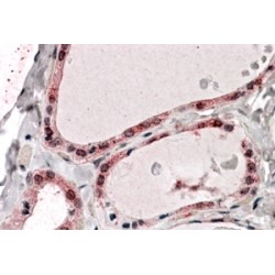 PP2A Antibody