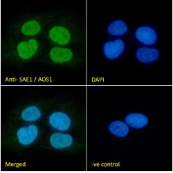 SUMO-Activating Enzyme Subunit 1 (SAE1) Antibody