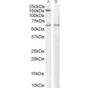 abx430295 staining (1 µg/ml) of Human immortilized lymphoblastoid lysate (RIPA buffer, 35 µg total protein per lane). Primary incubated for 1 hour. Detected by western blot using chemiluminescence.