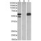 E3 ubiquitin-protein ligase TRIM21 (TRIM21) Antibody