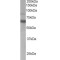 Anthrax Toxin Receptor 1 (ANTXR1) Antibody