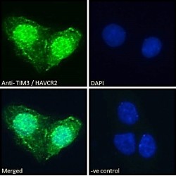 Hepatitis A Virus Cellular Receptor 2 (HAVCR2) Antibody