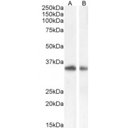 abx430303 (0.1 µg/ml) staining of A549 (A) and (0.5 µg/ml) HepG2 (B) cell lysate (35 µg protein in RIPA buffer). Detected by chemiluminescence.