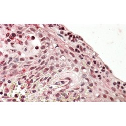 PR/SET Domain 1 (PRDM1) Antibody