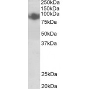 abx430329 (0.5 µg/ml) staining of A431 lysate (35 µg protein in RIPA buffer). Detected by chemiluminescence.