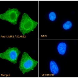 LIMP2 Antibody