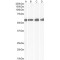 Corticotropin Releasing Hormone Receptor 1 (CRHR1) Antibody