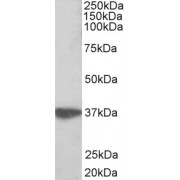 abx430337 (0.3 µg/ml) staining of Jurkat lysate (35 µg protein in RIPA buffer). Primary incubation was 1 hour. Detected by chemiluminescence.