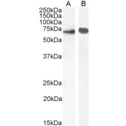 Protein Tyrosine Phosphatase, Non-Receptor Type 6 (PTPN6) Antibody