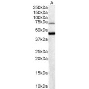 abx430348 (0.3 µg/ml) staining of Human Brain lysate (35 µg protein in RIPA buffer). Detected by chemiluminescence.