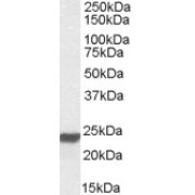 abx430350 (0.01 µg/ml) staining of Human Lung lysate (35 µg protein in RIPA buffer). Primary incubation was 1 hour. Detected by chemiluminescence.