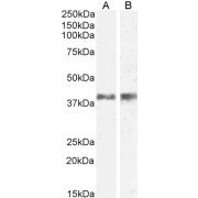 abx430358 (0.5 µg/ml) staining of Mouse (A) and Rat (B) Skin lysate (35 µg protein in RIPA buffer). Detected by chemiluminescence.